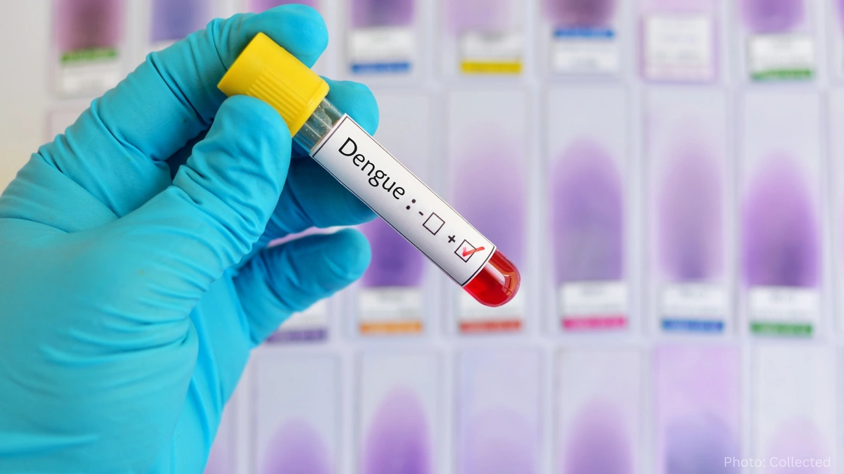 Dengue Fever Prevention and Early Detection Become Critical as Cases Rise During Mosquito Season