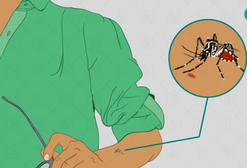 Symptoms of Dengue and Chikungunya: Know the Signs